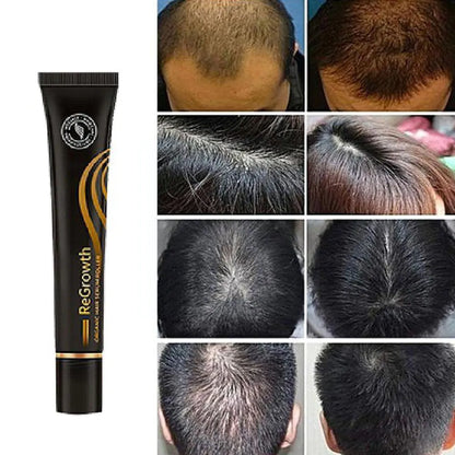 Regenerating Hair Growth Essential Oil and Perfume Essence