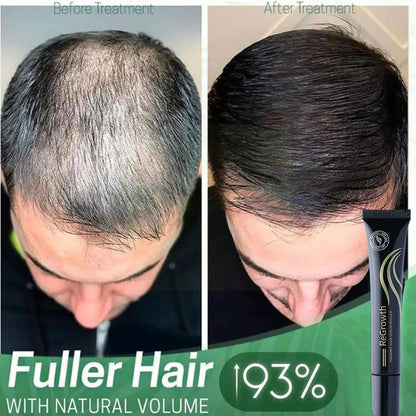 Regenerating Hair Growth Essential Oil and Perfume Essence