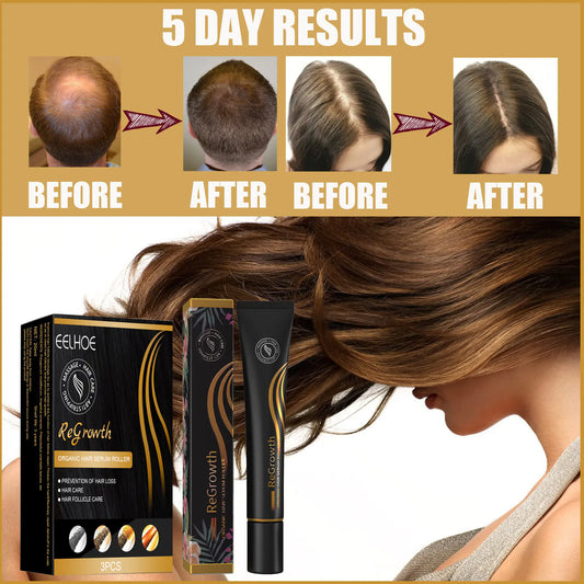 Regenerating Hair Growth Essential Oil and Perfume Essence